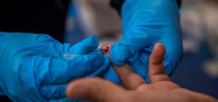 Colima reporta 108 nuevos casos de VIH en 2025, mayoría hombres