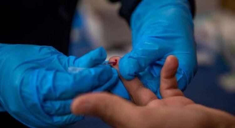 Colima reporta 108 nuevos casos de VIH en 2025, mayoría hombres